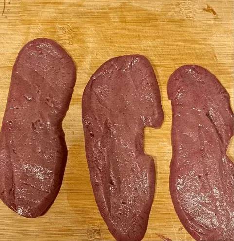 Kidneys Being Cleaned